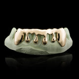 10K Gold Grillz Drip Design - Custom 2 Top Teeth (Covering total 4 teeth)