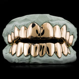 Non-Precious Gold Alloy Grillz - Custom Made 10 Top 10 Bottom Teeth