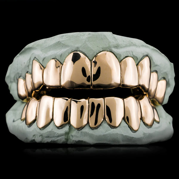 Solid Gold Grillz - Custom Made