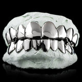 Non-Precious Gold Alloy Grillz - Custom Made 10 Top 10 Bottom Teeth